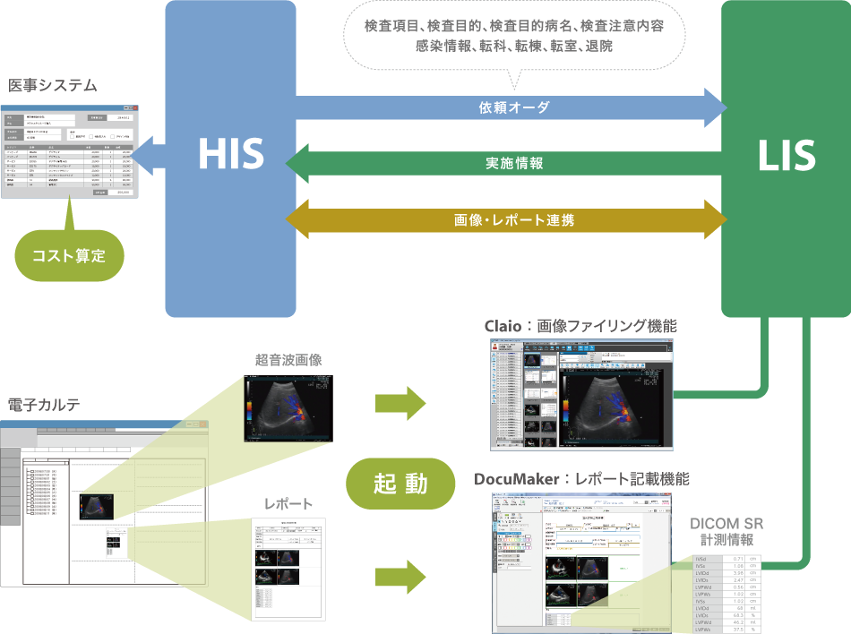 フロート図